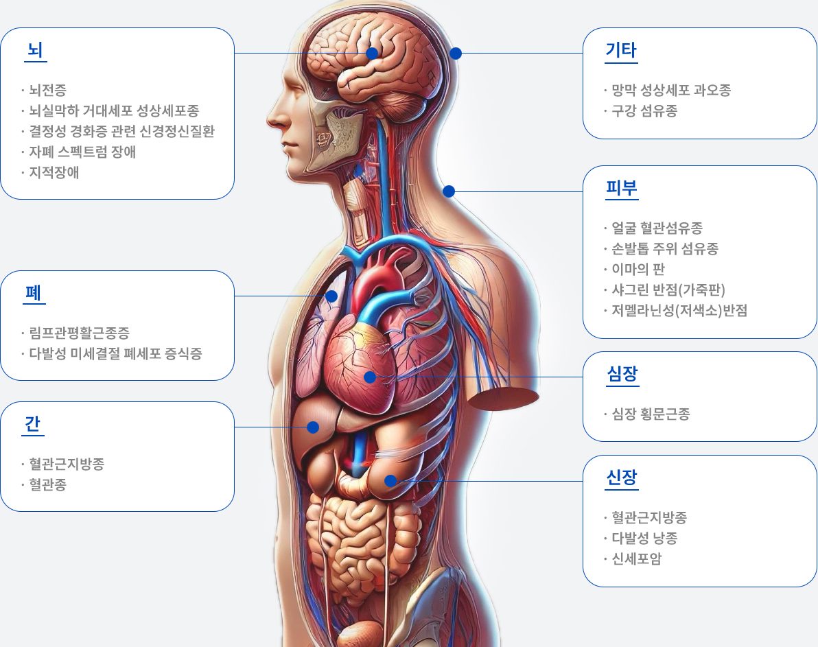 뇌/폐/간/기타/피부/심장/신장